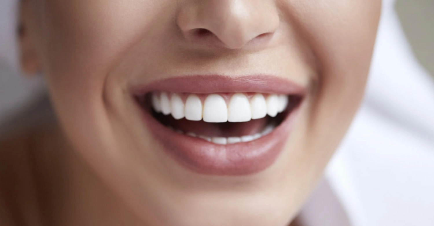 veneers price turkey In blog